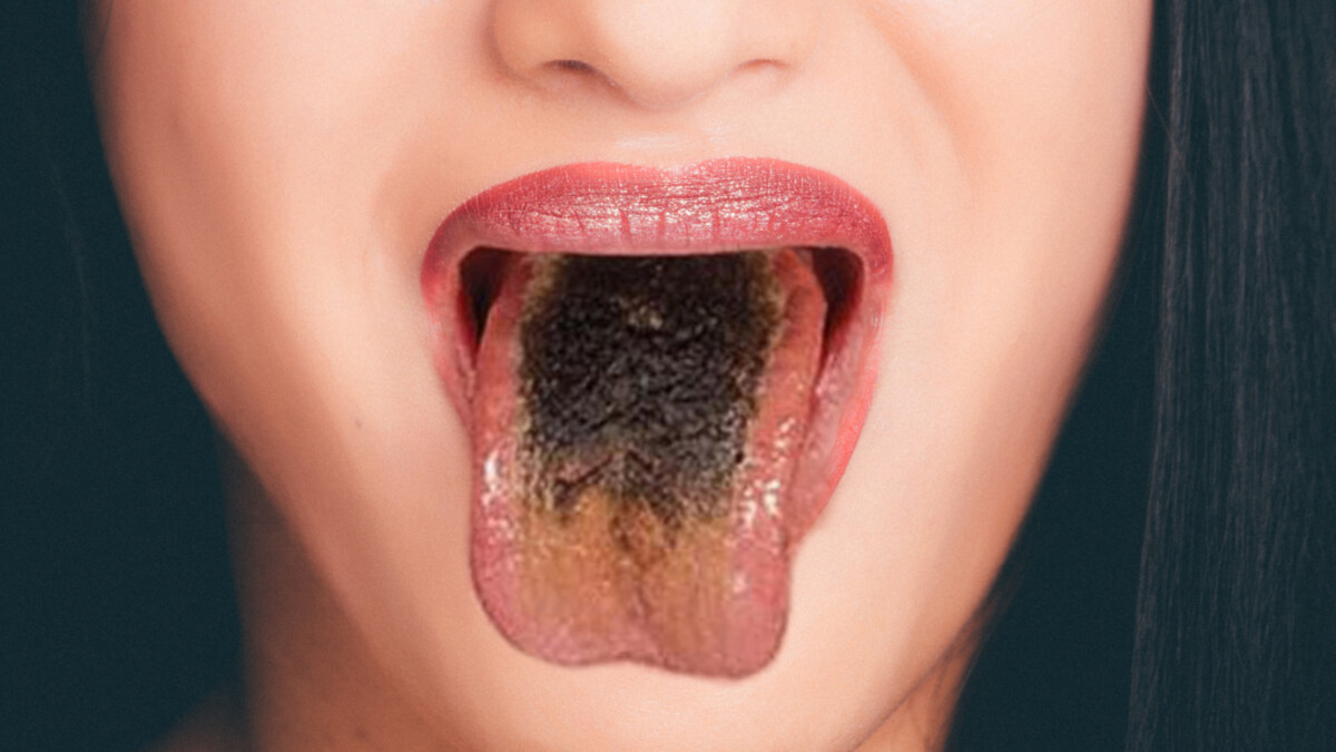tongue coating